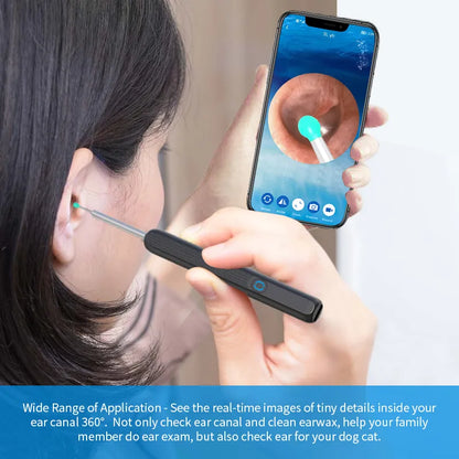 PrecisionEar Vue™ Smart Wax Removal Tool with Camera LED